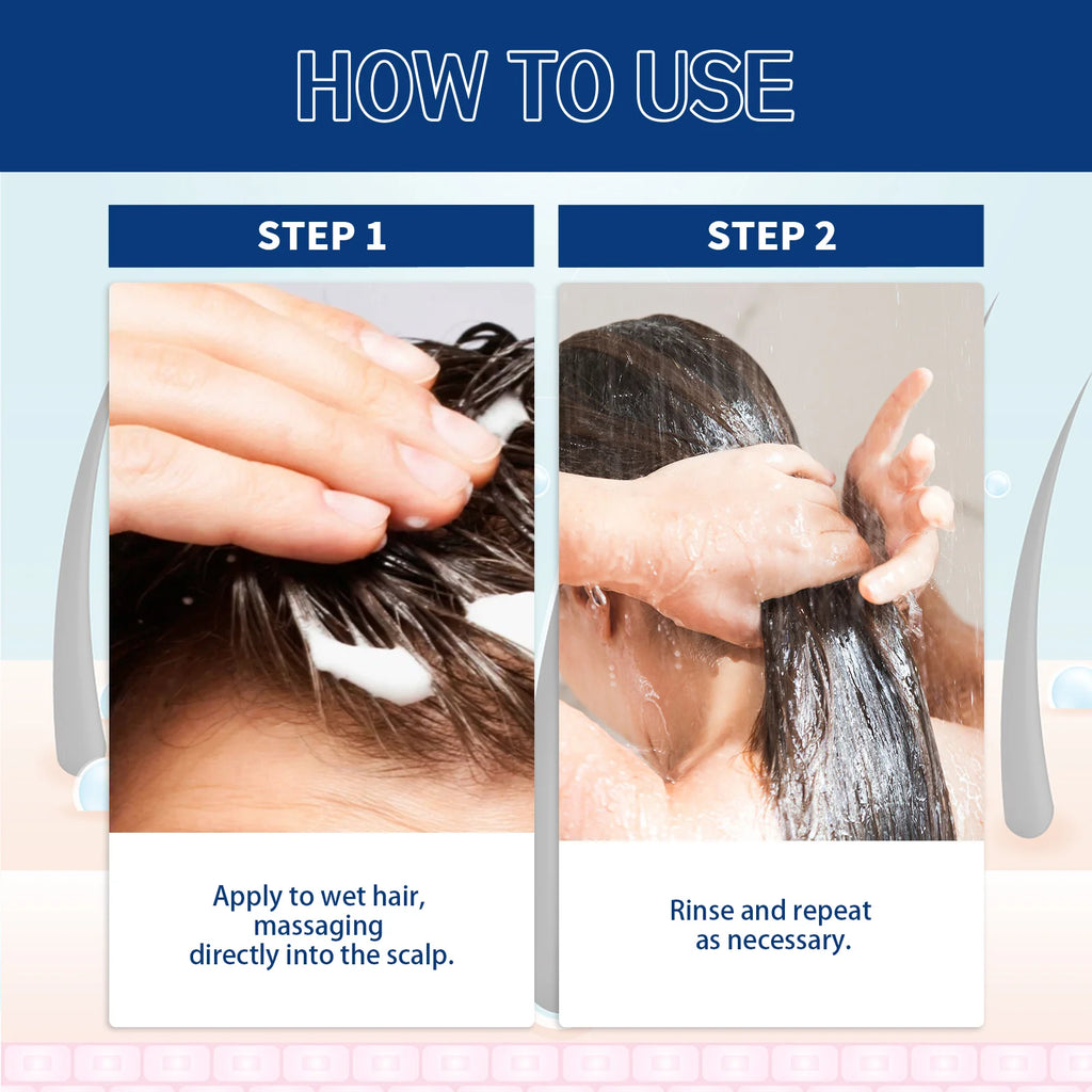 Scalp Scrub Shampoo Cream Dandruff Treatment Fast Hair Growth Anti Itching Hair Loss Hydrating Deep Scalp Cleansing Hair Care