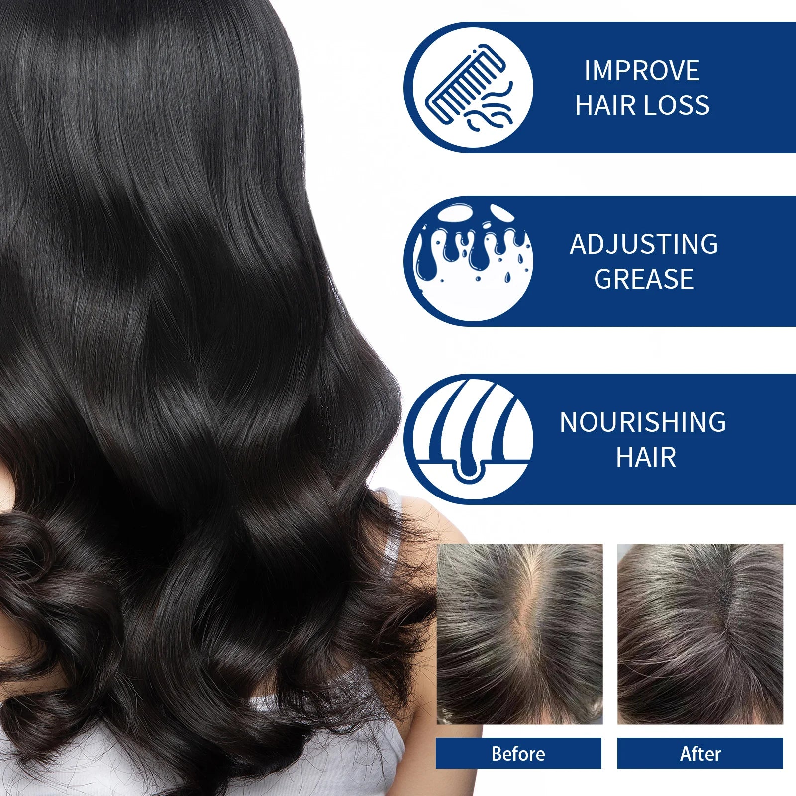 Scalp Scrub Shampoo Cream Dandruff Treatment Fast Hair Growth Anti Itching Hair Loss Hydrating Deep Scalp Cleansing Hair Care