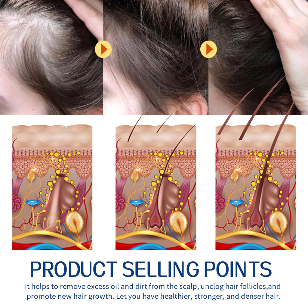 Scalp Scrub Shampoo Cream Dandruff Treatment Fast Hair Growth Anti Itching Hair Loss Hydrating Deep Scalp Cleansing Hair Care