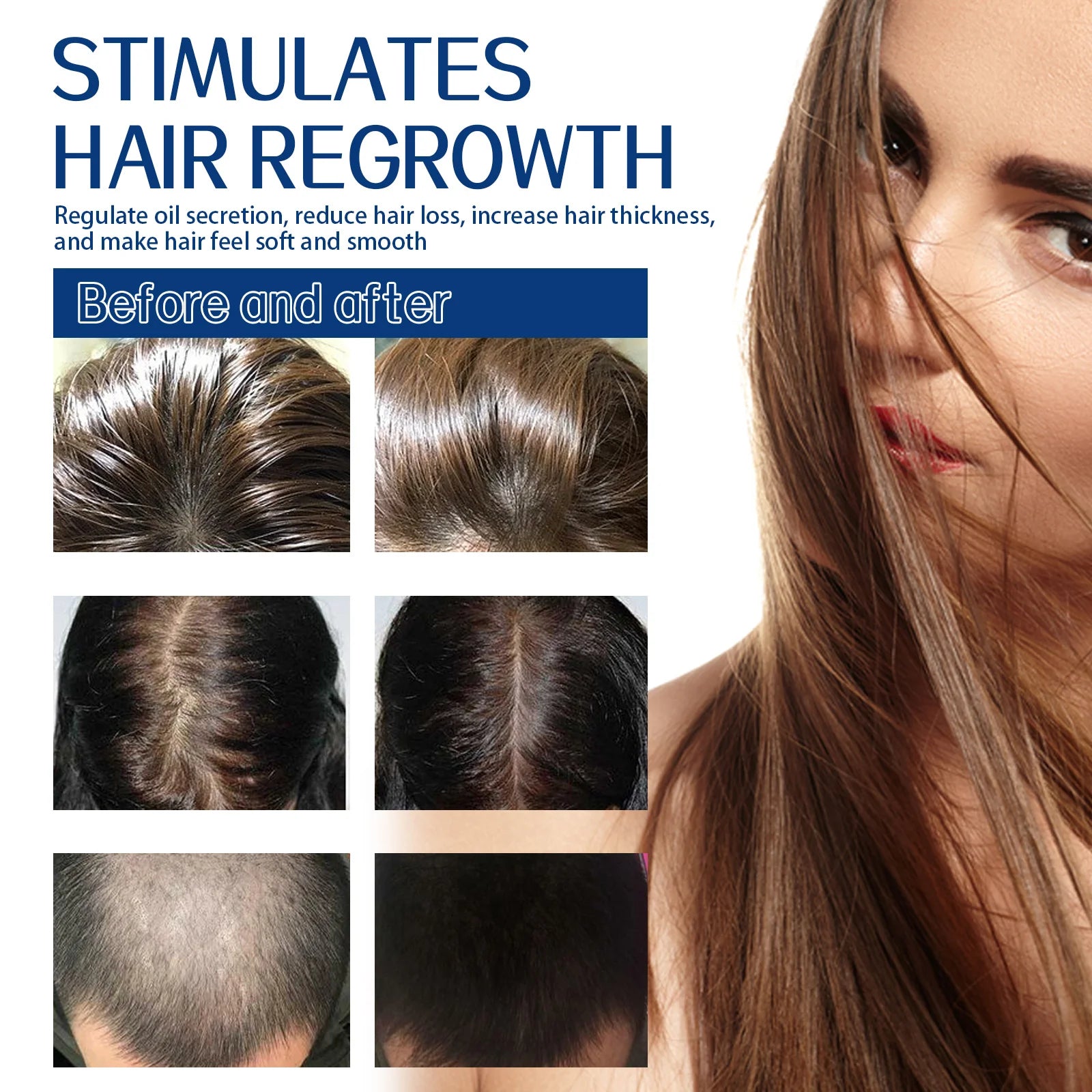 Scalp Scrub Shampoo Cream Dandruff Treatment Fast Hair Growth Anti Itching Hair Loss Hydrating Deep Scalp Cleansing Hair Care