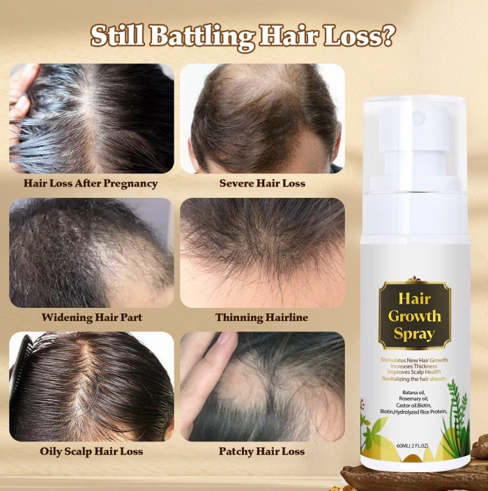 Natural Hair Growth Oil Spray - Battana Rosemary Serum Biotin Caffeine Scalp Treatment - Thinning Hair Regrowth And Thickening For Women And Men-It Is Forbidden To Sell On The TikTok Platform